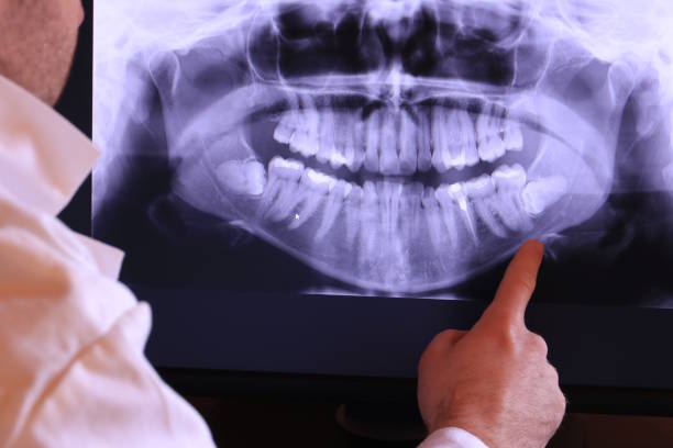 Best Broken or Chipped Tooth Repair in Swedeland, PA